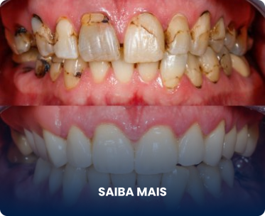 Exemplo 1, Imagem de procedimento bem feito